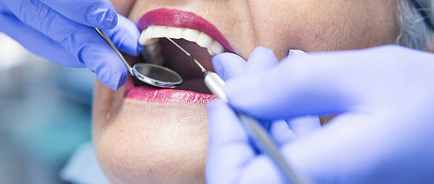 Best Emergency Tooth Extraction in Rutherford, NJ